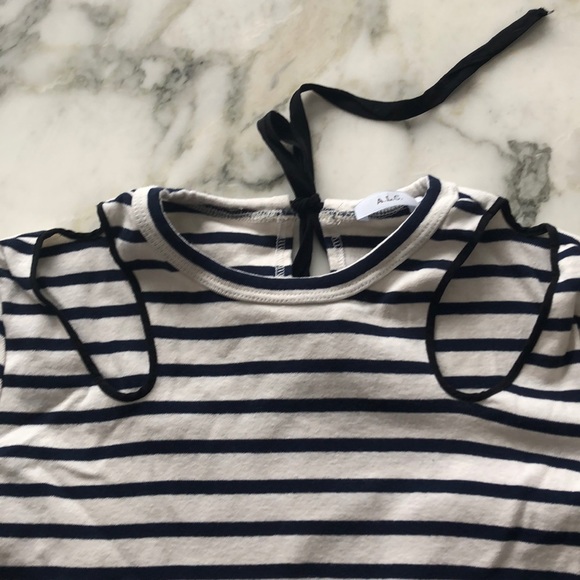 ALC striped top Xs - Picture 4 of 7